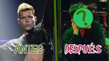 Ricky Martin se marca un Mickey Rourke y ya no es el artista más guapo de Latinoamérica