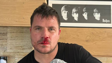 Dani Martín comparte una imagen con la nariz sangrando tras terminar de boxear: "Si es sangre, nada más"
